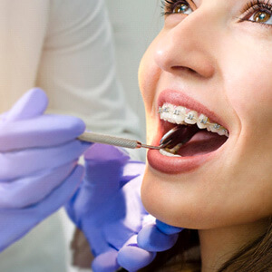 orhtodontist examining the mouth of a woman with braces